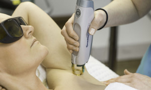 Rejuvenate The-Dos-and-Don’t-of-Laser-Hair-Removal