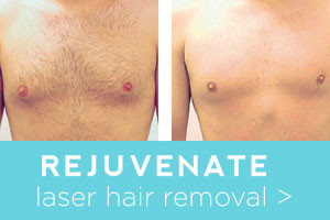 Rejuvenate before and after laser hair removal